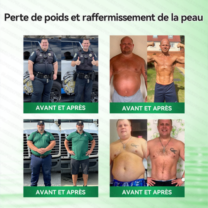 𝐁𝐨𝐮𝐭𝐢𝐪𝐮𝐞 𝐎𝐟𝐟𝐢𝐜𝐢𝐞𝐥𝐥𝐞 | 🇫🇷🌱🐵 𝐆𝐋𝐎𝑹𝑬𝗡𝗗𝗔® 𝑴𝒐𝒓𝒊𝒏𝙜𝙖 · 𝘽𝙚𝙧𝙗𝙚𝙧𝒊𝒏𝒆 × 𝐍𝐴𝑫+ 𝟏𝟎-𝗲𝗻-𝟏 𝑵𝒂𝙣𝙤 𝑴𝒊𝒄𝒓𝒐𝒏𝒆𝒆𝗱𝗹𝗲 𝐀𝐯𝐚𝐧𝐜é 𝐏𝐚𝒕𝗰𝗵 🇫🇷 (𝐔𝐧𝐞 𝐬𝐞𝐮𝐥𝐞 𝐟𝐨𝐢𝐬 𝐩𝐚𝐫 𝐣𝐨𝐮𝐫) ✅ 𝐏𝐨𝐮𝐫 𝐥’𝐨𝐛é𝐬𝐢𝐭é, 𝐩𝐞𝐚𝐮 𝐫𝐞𝐥â𝐜𝐡é𝐞, 𝐝𝐢𝐚𝐛è𝐭𝐞, 𝐚𝐩𝐧é𝐞 𝐝𝐮 𝐬𝐨𝐦𝐦𝐞𝐢𝐥, 𝐩𝐫𝐨𝐛𝐥è𝐦𝐞𝐬 𝐚𝐫𝐭𝐢𝐜𝐮𝐥𝐚𝐢𝐫𝐞𝐬, 𝐞𝐭 𝐛𝐢𝐞𝐧 𝐩𝐥𝐮𝐬🎁